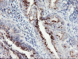 GCP60 / ACBD3 Antibody (clone OTI3E7)