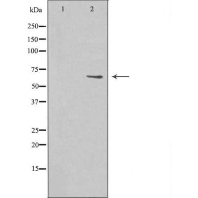 MARCKS Antibody