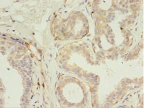 Polyclonal Rabbit anti-Human RERG Antibody (aa1-199, IHC, WB)