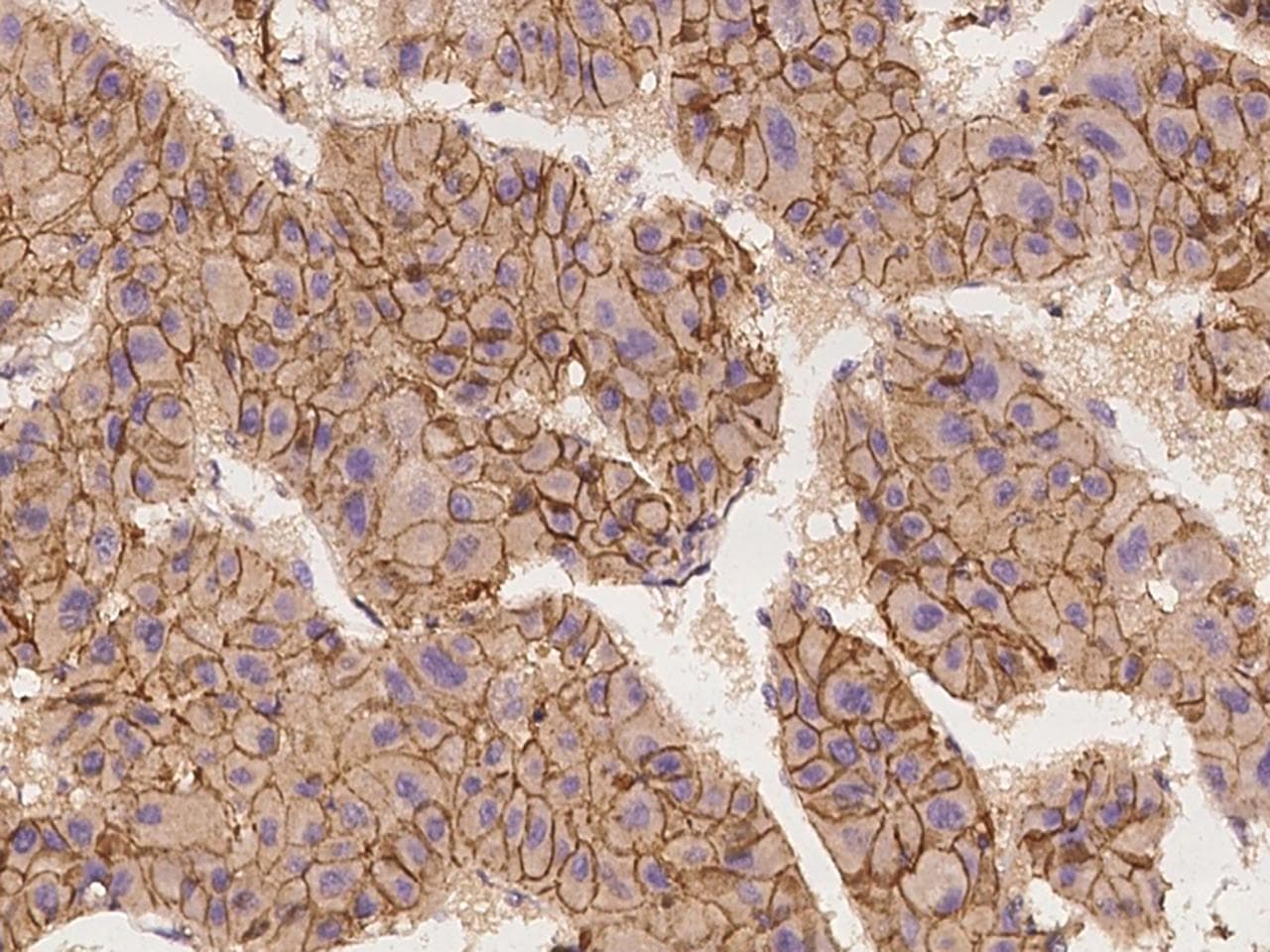 CDH2 / N Cadherin Antibody