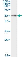 ANGPTL4 Antibody (clone 1A12)