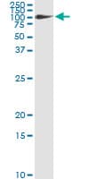 Monoclonal Mouse anti-Human FBLN1 / Fibulin 1 Antibody (clone 4C9, WB)