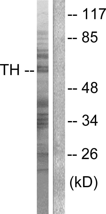 IHC-plus™ Polyclonal Rabbit anti-Human TH / Tyrosine Hydroxylase Antibody (aa41-90, IHC, IF, WB)