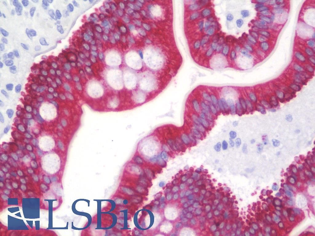 Cytokeratin AE1+AE3 Antibody (clone CK 210 and CK 211)