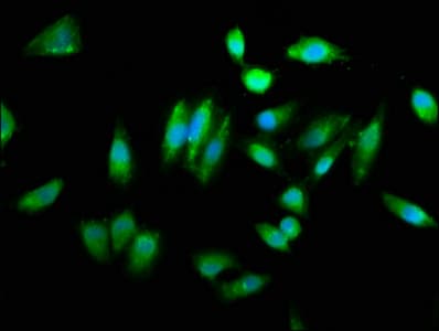 CHAC1 / MGC4504 Antibody