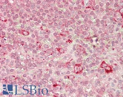 IHC-plus™ RANGAP1 Antibody (clone 1B4)