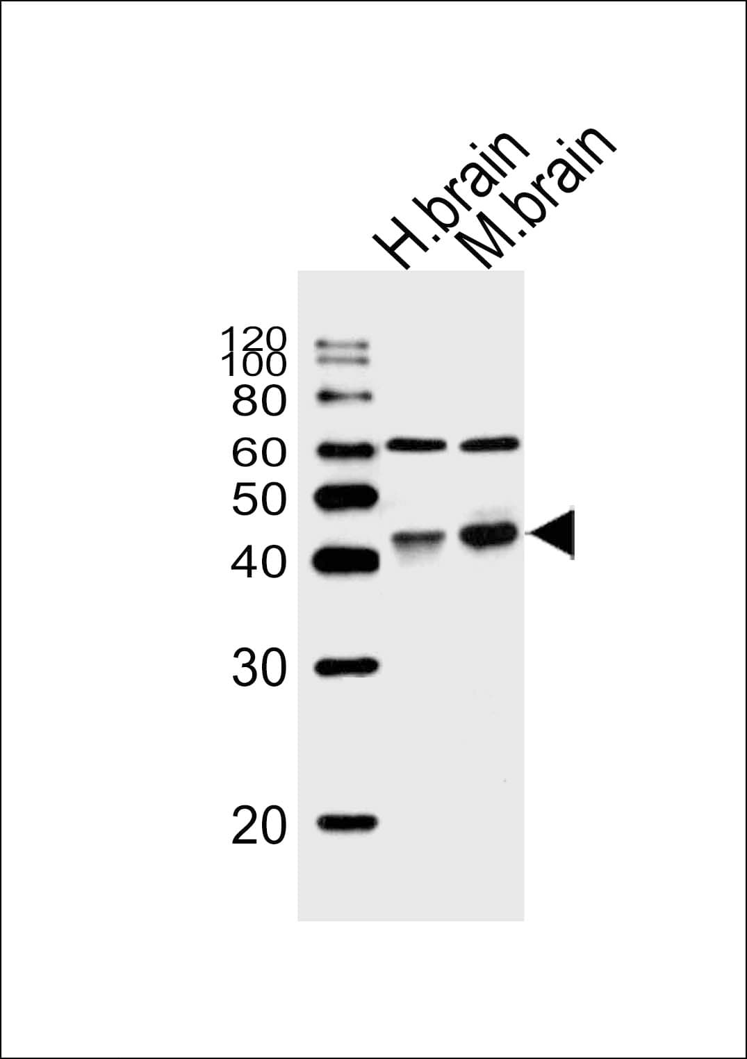 Polyclonal Rabbit anti-Human WNT16 Antibody (aa236-265, IHC, WB)