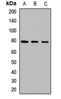 Polyclonal Rabbit anti-Human EIF2B5 Antibody (WB)
