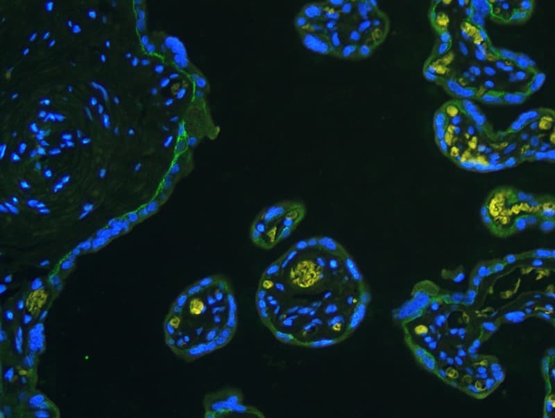 ITGB4 / Integrin Beta 4 Antibody (aa28-266)