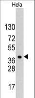 HDGF Antibody (aa171-197)