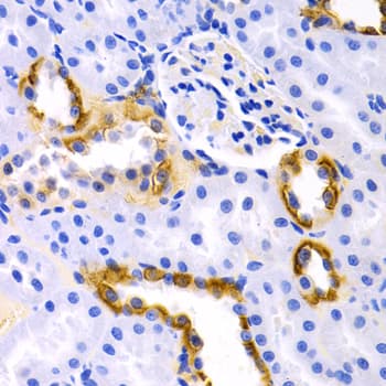 DRD1 / Dopamine Receptor D1 Antibody (aa338-446)
