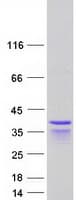 Human PPHLN1 Protein (Recombinant Myc-DDK (Flag))