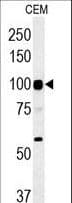 ATP6V0A4 Antibody (aa235-261)