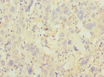 TRHDE Antibody