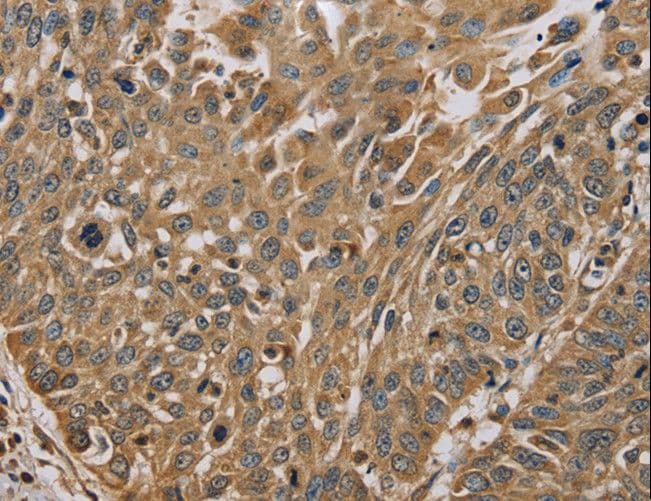 MYL3 Antibody