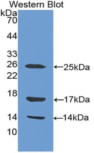 LL37 / Cathelicidin Antibody (aa31-170)