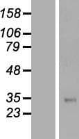 TFPI / LACI Protein (Over-Expression Lysate Myc-DDK (Flag))