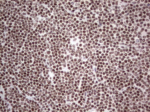 HDAC9 Antibody (aa181-460, clone OTI7G2, Carrier-free)