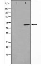 RELA / NFKB p65 Antibody