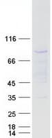 Human C1orf38 Protein (Recombinant Myc-DDK (Flag))