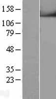 Human TRPM4 Protein (Over-Expression Lysate Myc-DDK (Flag))