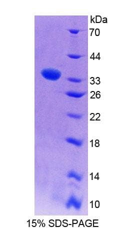 Rat PLCE1 Protein (Recombinant His-T7, N-terminus)