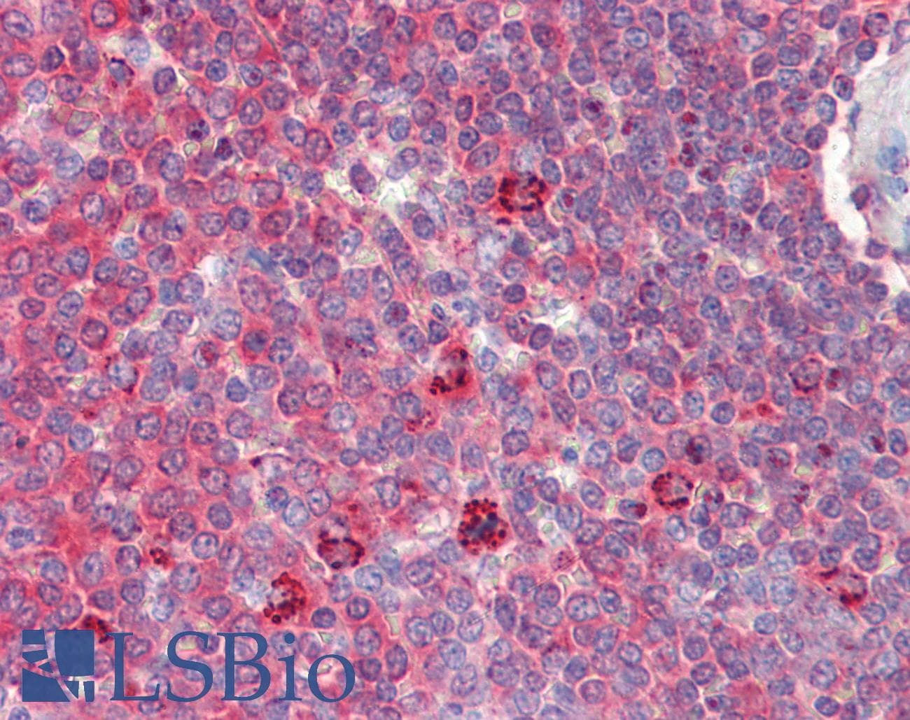 IHC-plus™ HSPD1 / HSP60 Antibody (clone Mab-11-13)