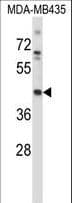 Polyclonal Rabbit anti-Mouse MAP2K1 / MKK1 / MEK1 Antibody (aa269-296, IHC, WB)