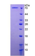Human INHBB / Inhibin Beta B Protein (Recombinant His-GST)
