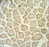 PGP Antibody (aa33-62)