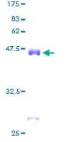 Human CSRP2 Protein (Recombinant GST)