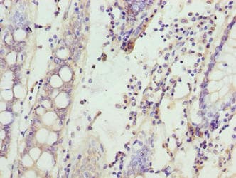 SPTLC3 / C20orf38 Antibody