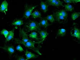 TUBAL3 Antibody (clone OTI4D8)
