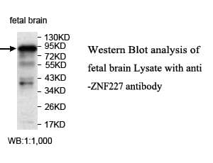 Polyclonal Rabbit anti-Human ZNF227 Antibody (WB)