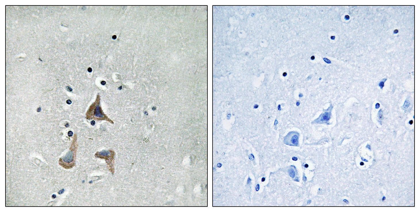 Polyclonal Rabbit anti-Human RGR Antibody (IHC, IF)