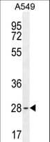 Polyclonal Rabbit anti-Human BTF3 Antibody (aa1-30, WB)