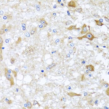 ABCB8 Antibody