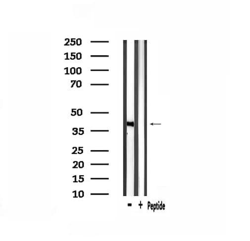 GPR139 Antibody