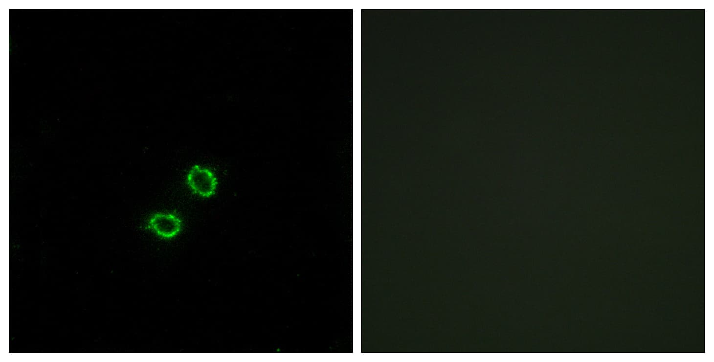 KIR2DL5A / KIR2DL5 Antibody (aa161-210)