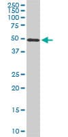 STK38 Antibody (clone 3A5)
