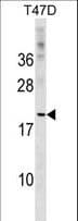 Polyclonal Rabbit anti-Human CLEC4D / MCL Antibody (aa126-153, WB)