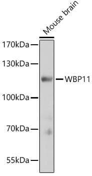 Polyclonal Rabbit anti-Human WBP11 Antibody (WB)