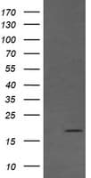 CTAG1B / NY-ESO-1 Antibody (clone OTI5G3)