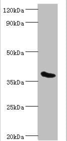 RD / PHYH Antibody (aa1-338)