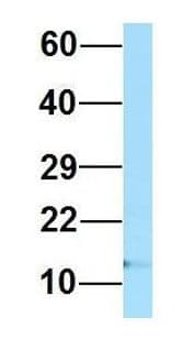 RPL36AL Antibody (C-Terminus)