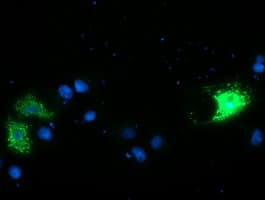 CAMLG / CAML Antibody (clone OTI2H3)