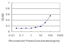 PGM3 Antibody (clone 1E2-1B12)