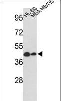 GSDMB / Gasdermin-Like Antibody (aa208-237)