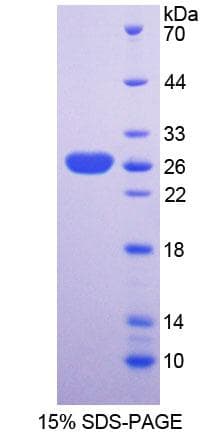 Mouse SNX18 Protein (Recombinant His-T7)