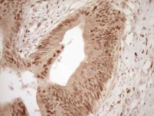 Monoclonal Mouse anti-Human GFI1 Antibody (clone OTI6E8, aa1-180, IHC, WB)